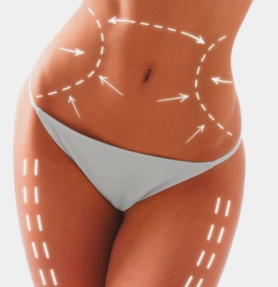 Slăbire localizată/Lipoliză